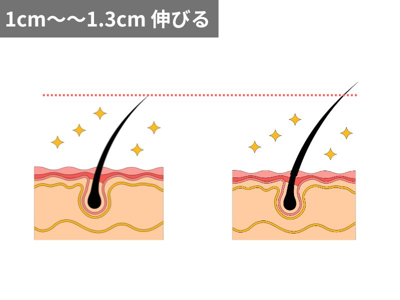 髪は1ヶ月で1cmから1.3cm伸びる